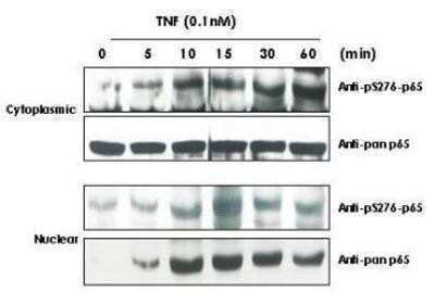 Western Blot: RelA/NFkB p65 [p Ser529] Antibody [NBP1-77808]
